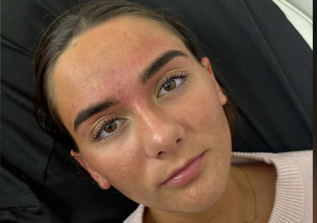 Koreon Lash Lift