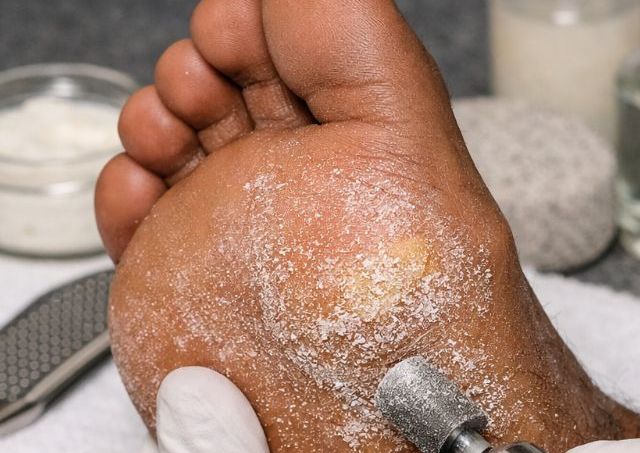 Male Exfoliating Pedicure