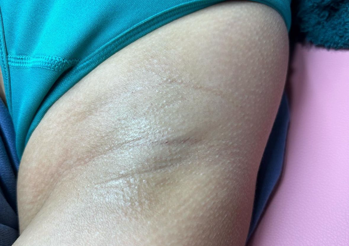 underarm wax