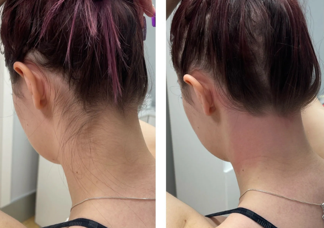 neck wax 