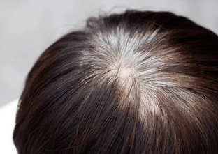 ROOT / BASE  RETOUCH