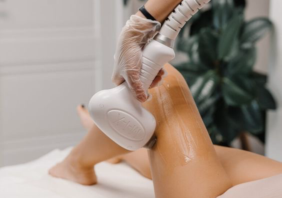 Laser Hair removal (all zones)