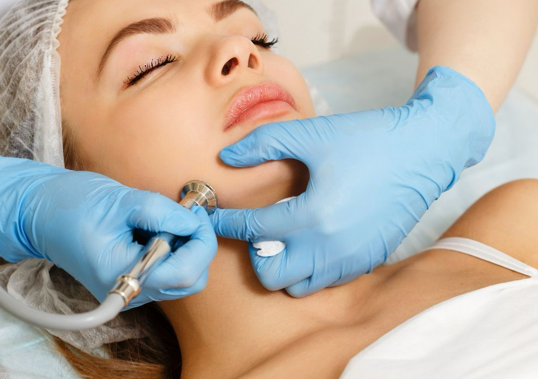Microdermabrasion
