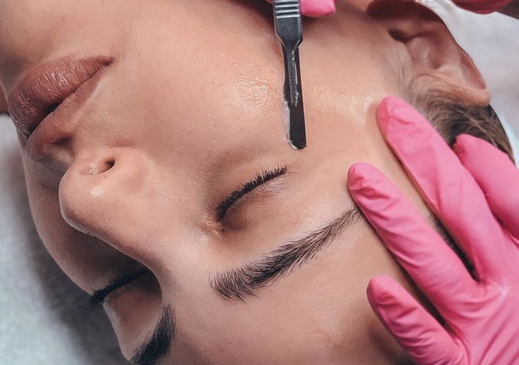 Dermaplaning