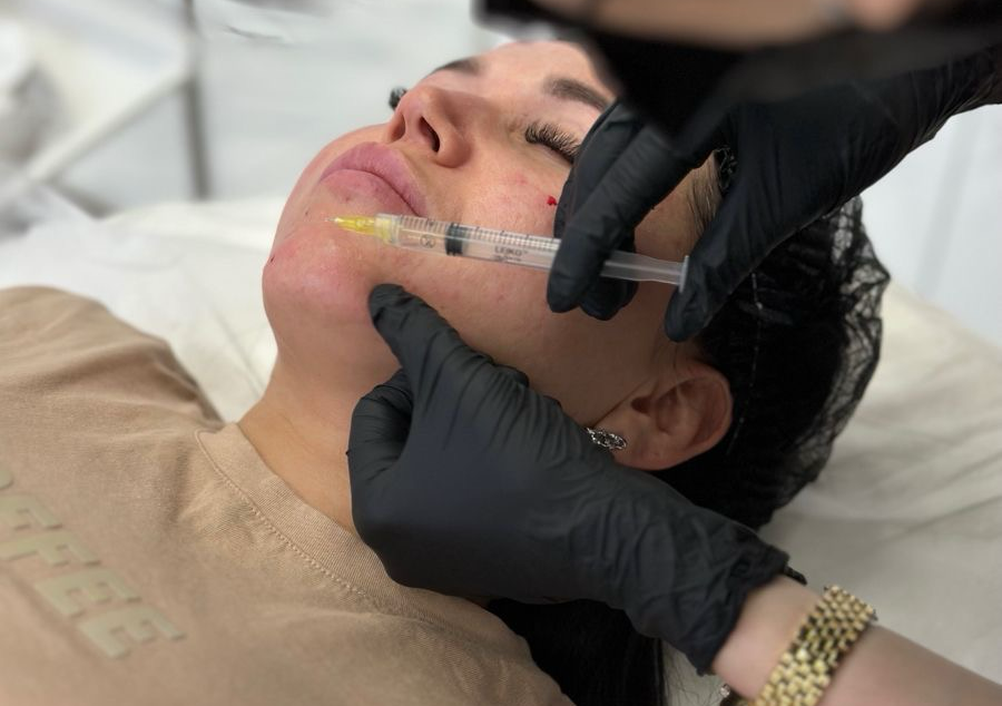 PRP  (Platelet-Rich Plasma)