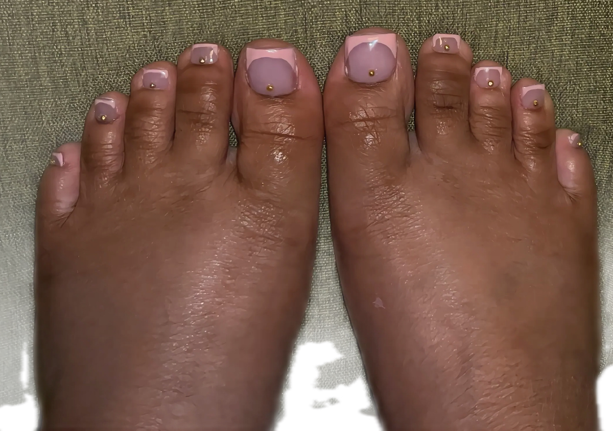 Full toe set 