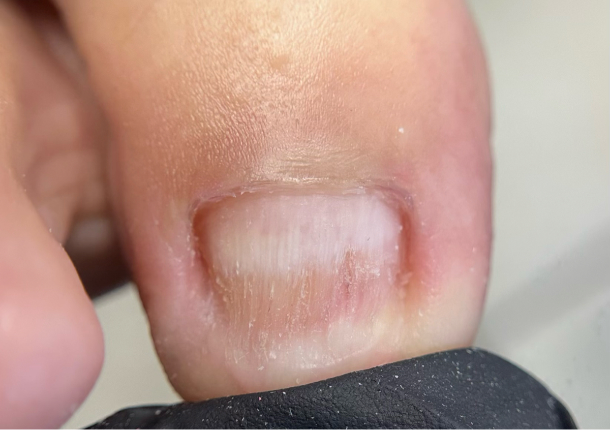  Limpieza Profunda  👣🦠