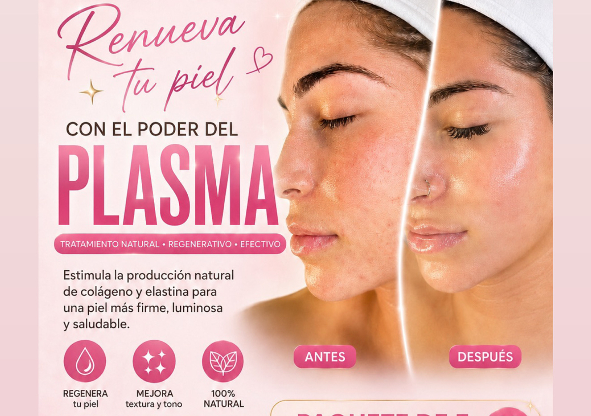 3  PRP 