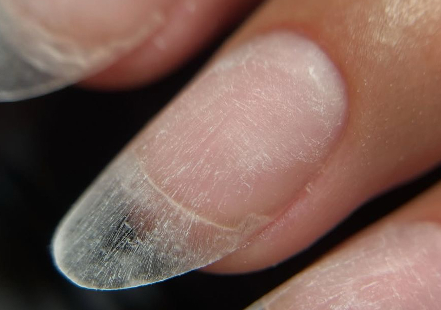 💅 Reemplazo de Uña (una uña) 