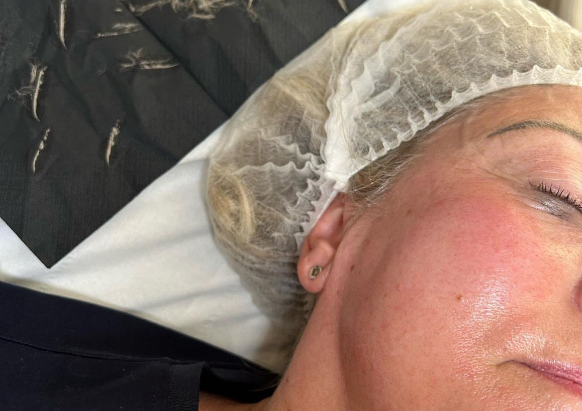 Dermaplaning Deluxe facial