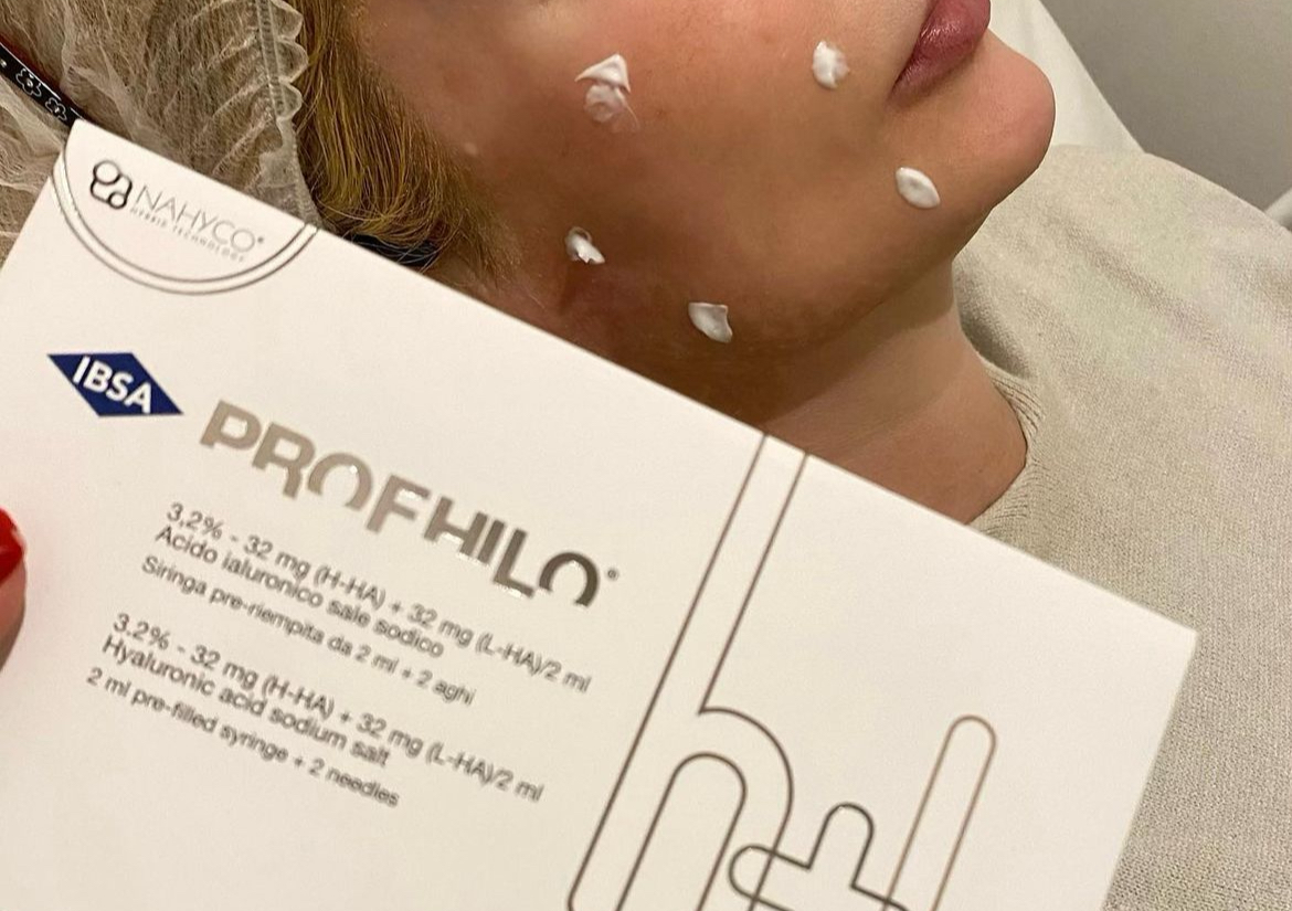 Profhilo face