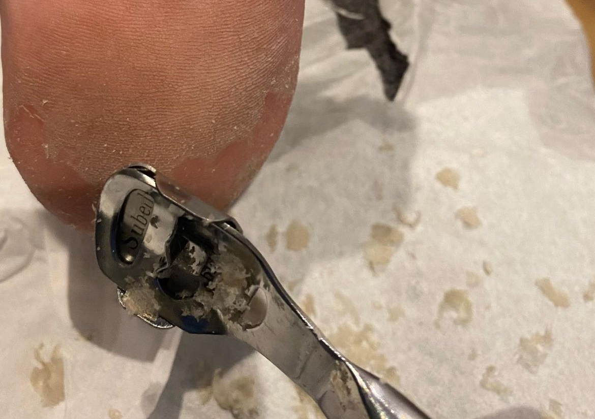 Pedicure 