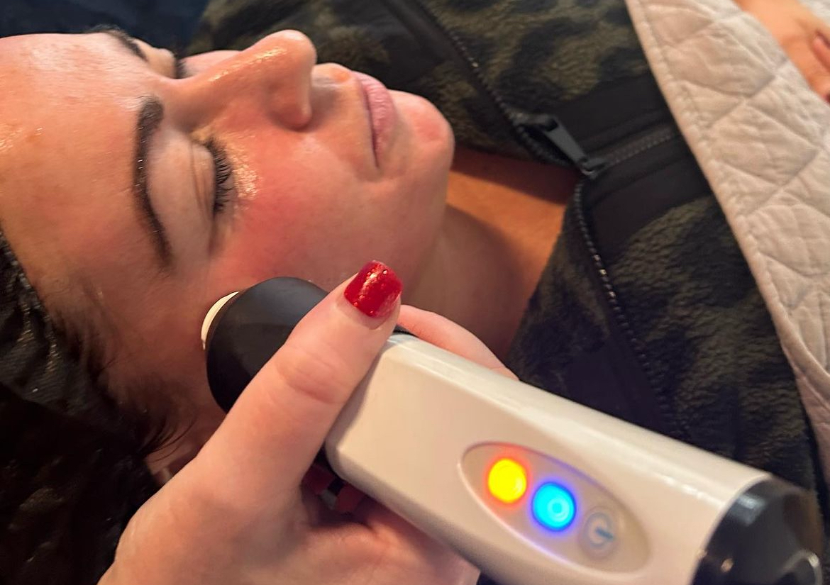 Radio Frequency facial