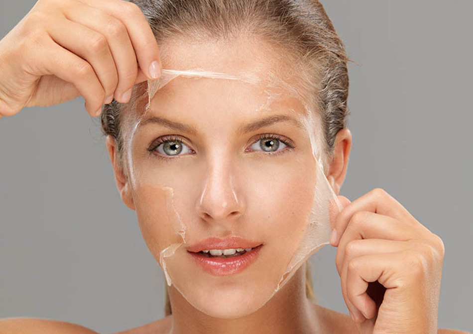 Peeling quimico
