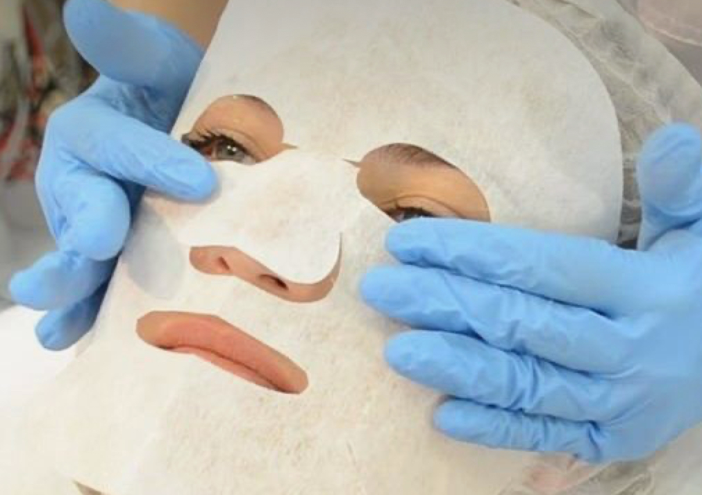 Carboxy terapia co2 sin agujas