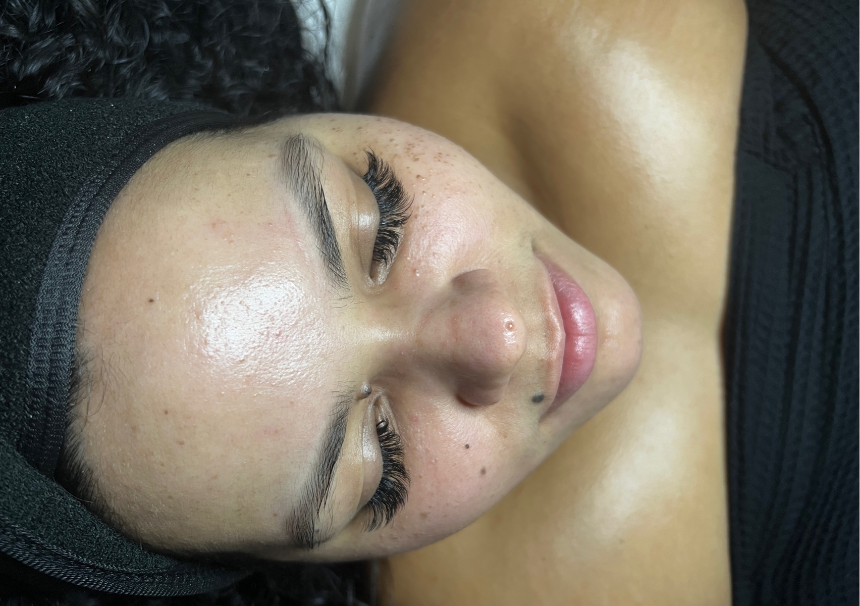 Hydrafacial