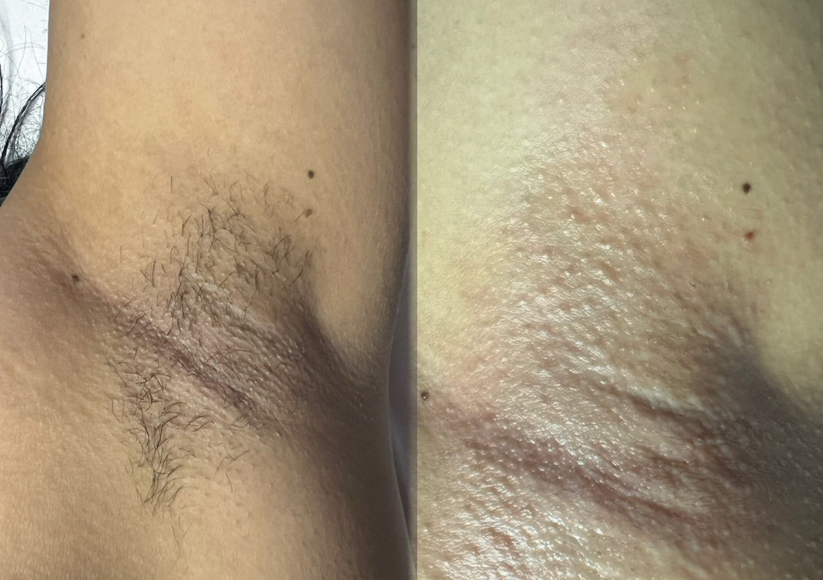 Underarm  Wax/ Axilas