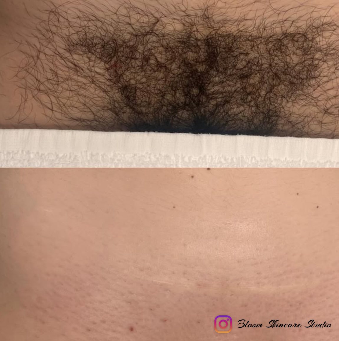 ✨Offer Brazilian Wax ✨