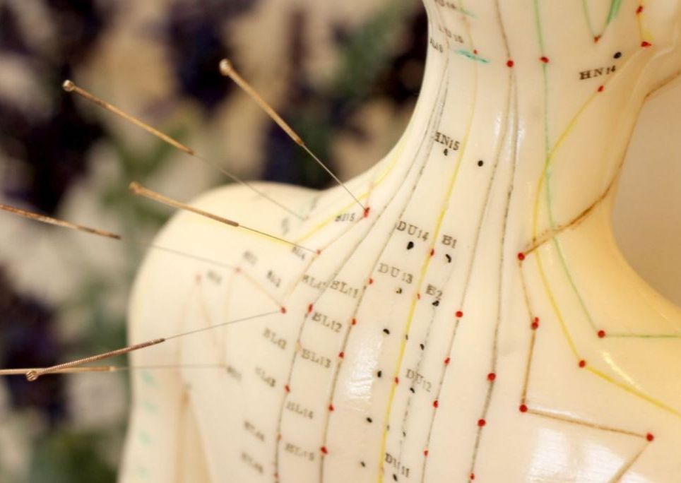 Acupuncture