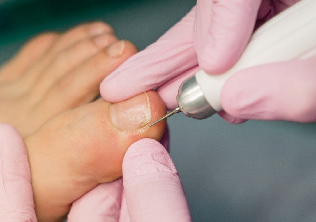 STILIZARE PEDICHIURA