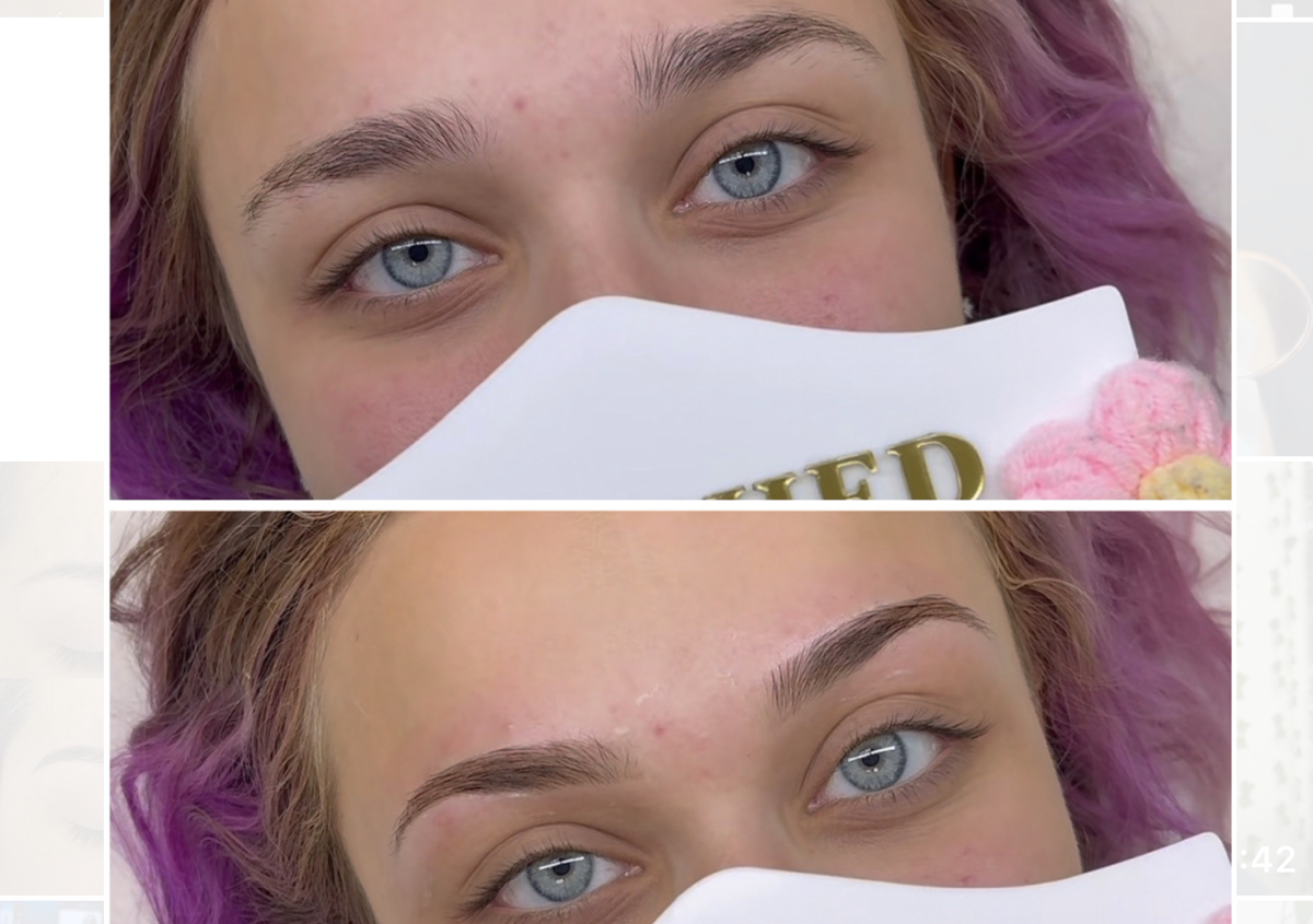 Brow bundle 