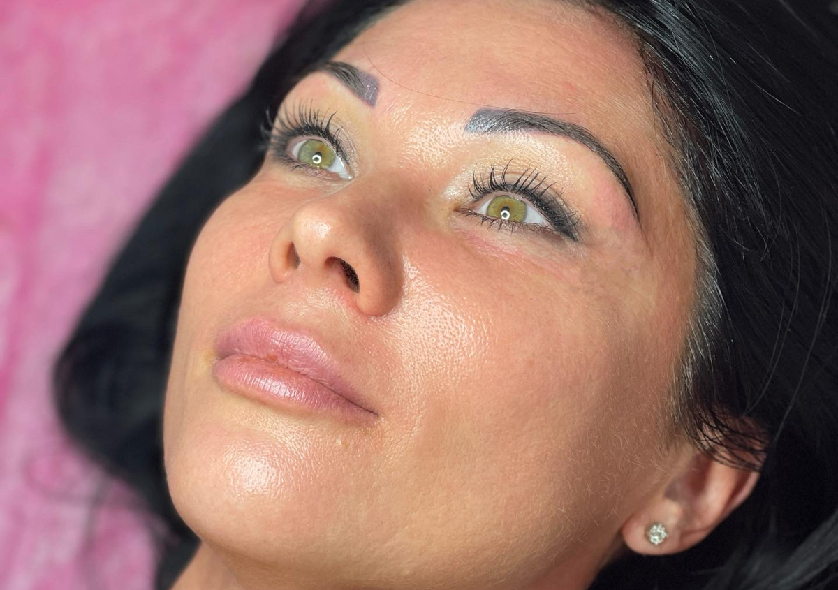 Hydrodermabrasion Facial