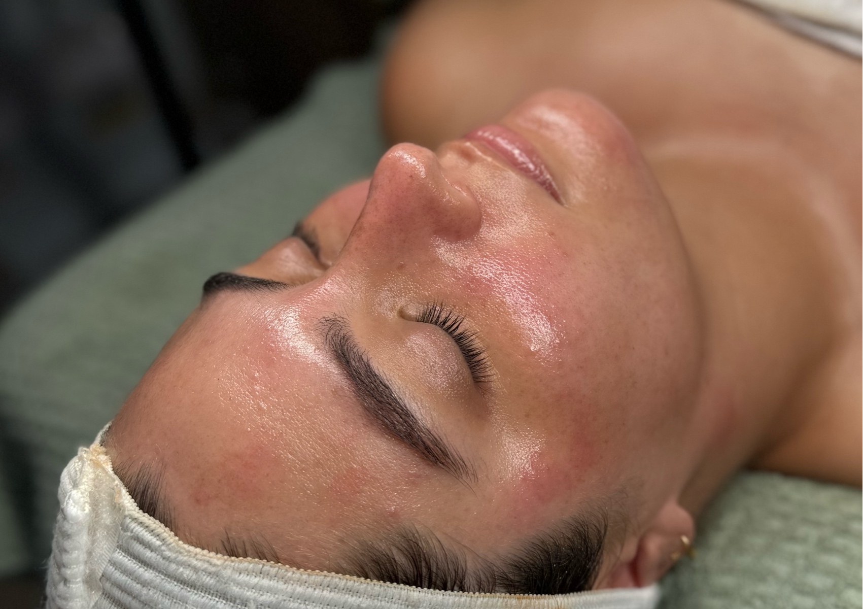 MicroNeedling Facial 