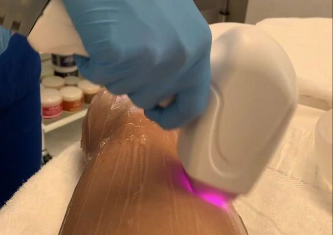 Pierna Completa / retoque 