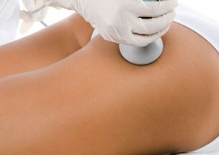 Gluteos (5 sesiones)