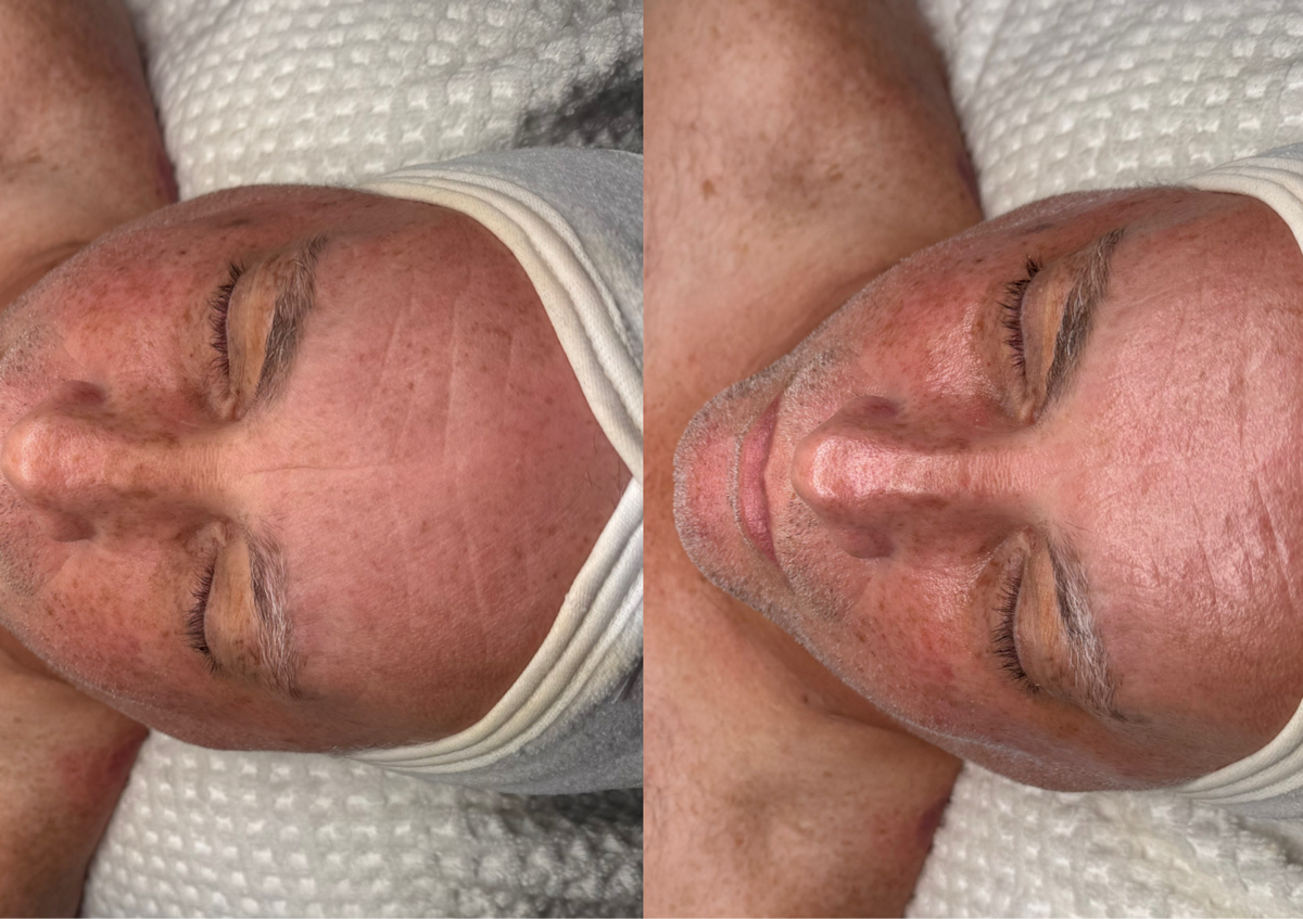 Deep Cleanse Facial (limpieza profunda)