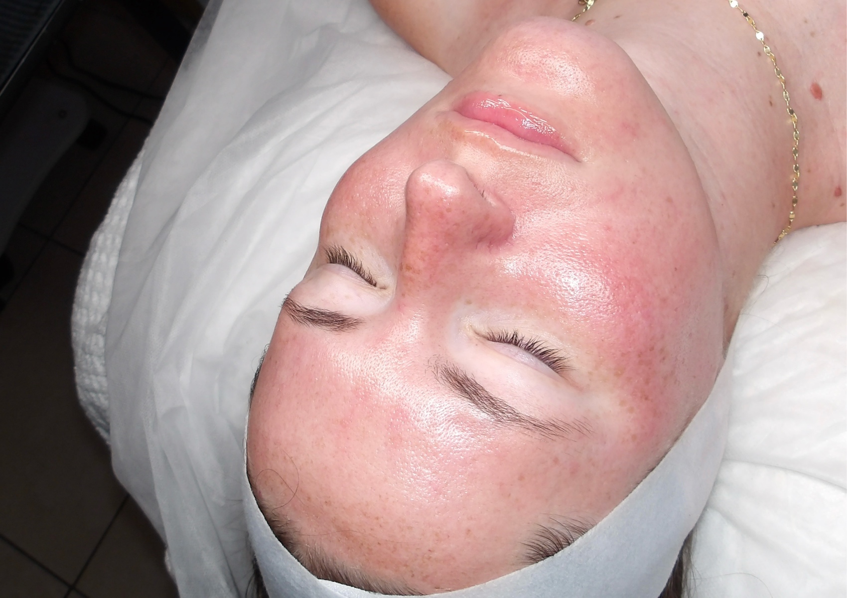Sensitive Facial for my ROSACEA people
