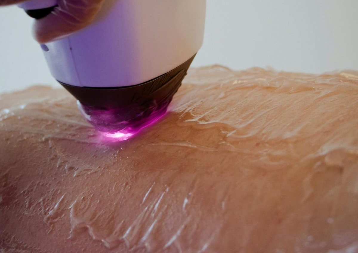 Abdomen (5 sesiones) 