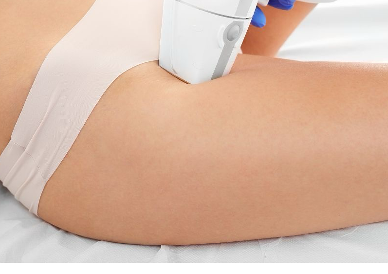 Bikini Line / retoque 