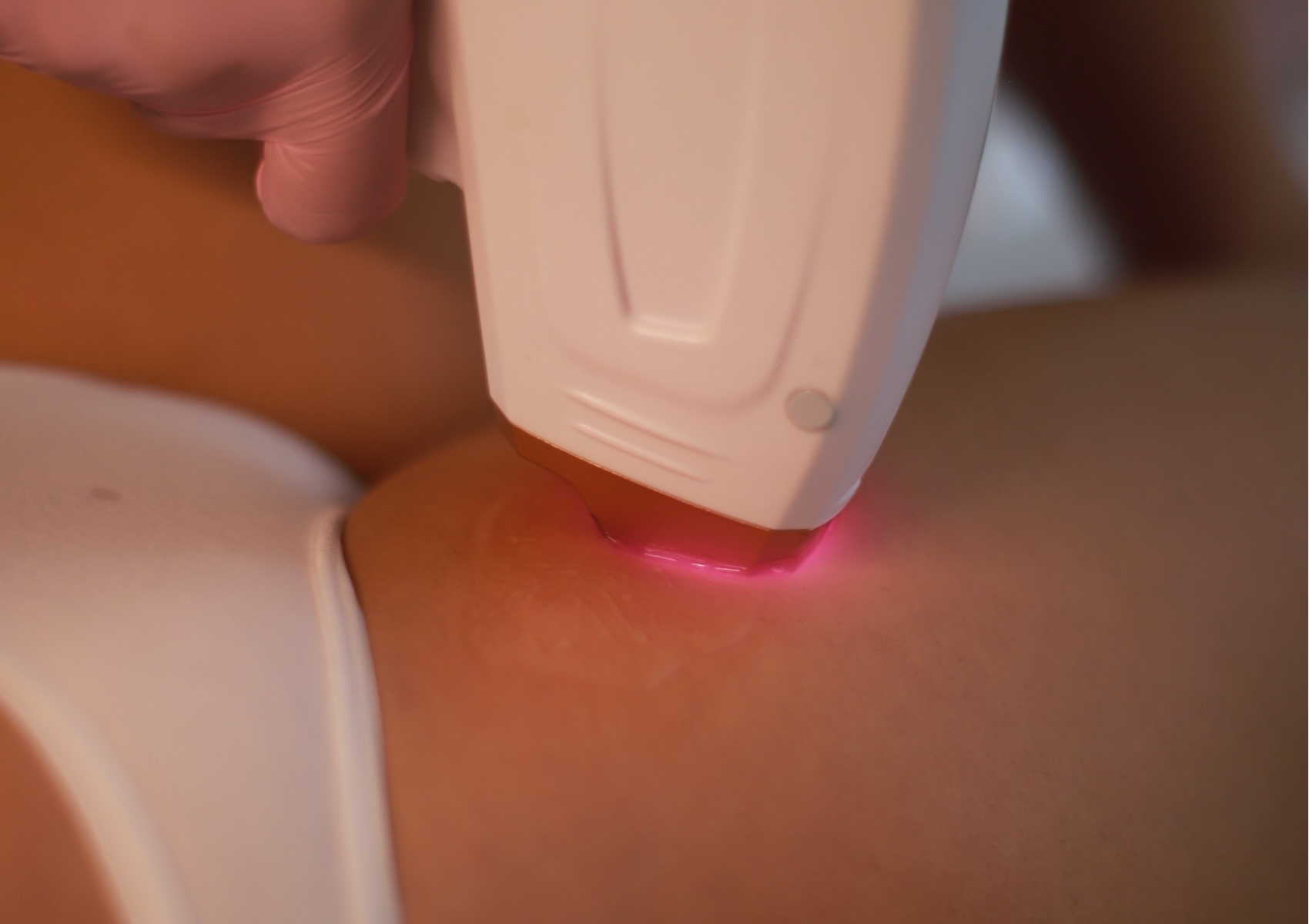 Depilación Láser Primera cita