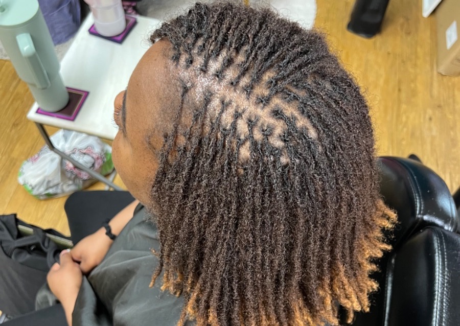 Microlock Consultation (Please Call for Appointment)