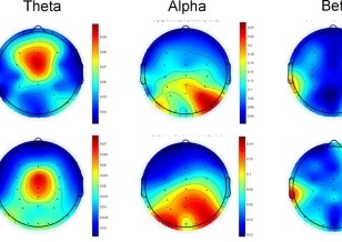Brain Mapping [QEEG]