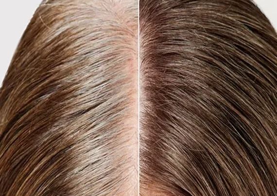 Root Retouch