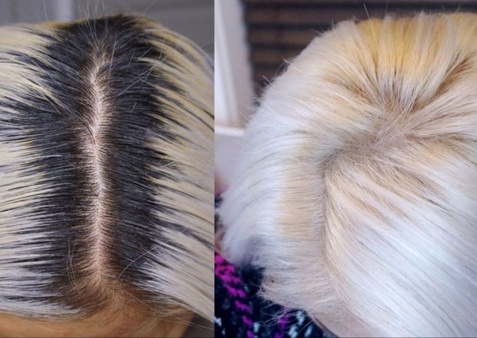 Root Lightening