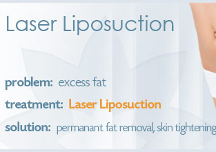 Lipo Laser Fat reduction {body}（激光吸脂）