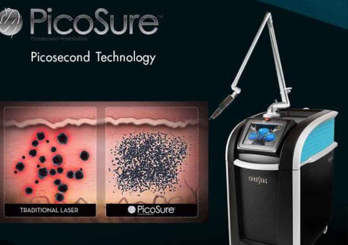 Cynosure Pico Laser Tattoo Removal(皮秒去纹身）