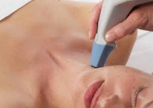 Btl skin tightening 