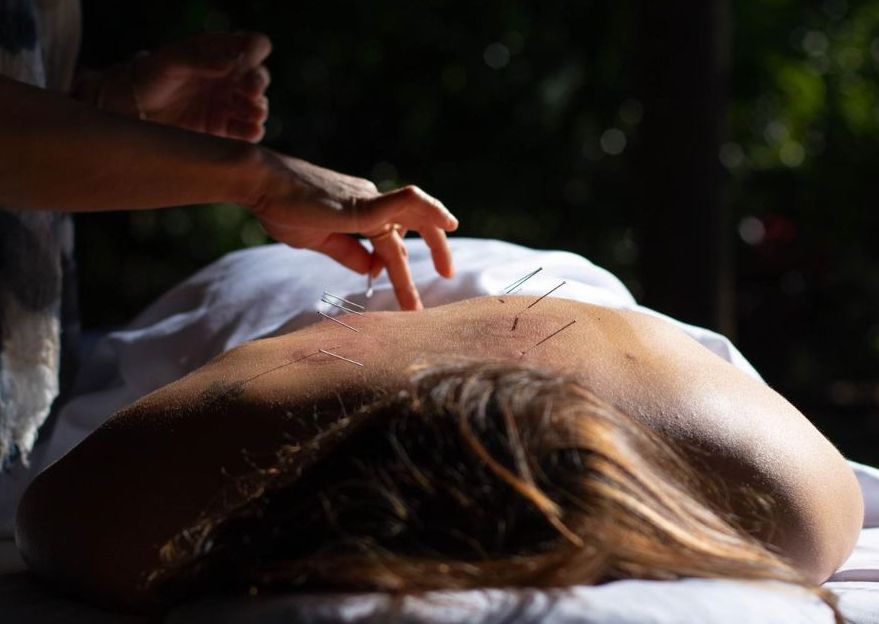 Initial Acupuncture Consultation with Melissa