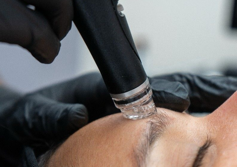 Hydrafacial