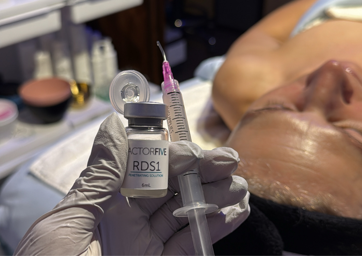 RDS Factor Five Peel