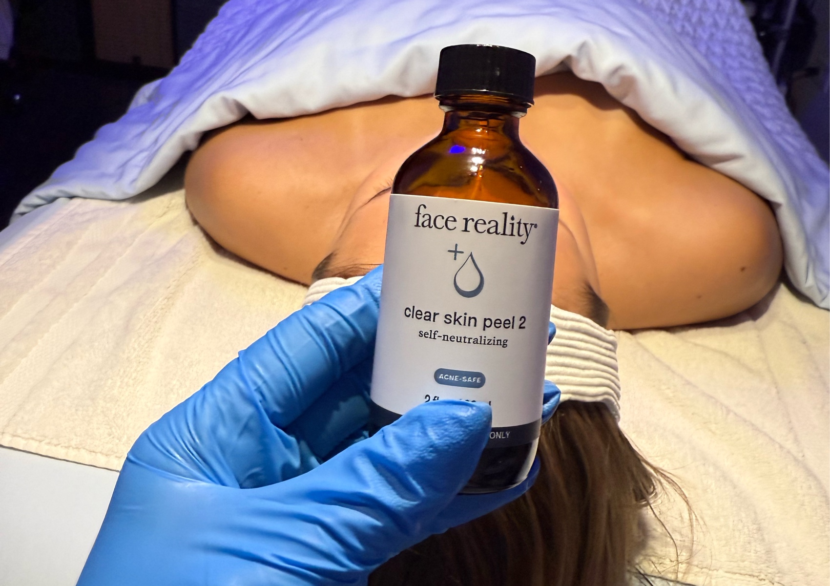 Acne Bootcamp Treatment 