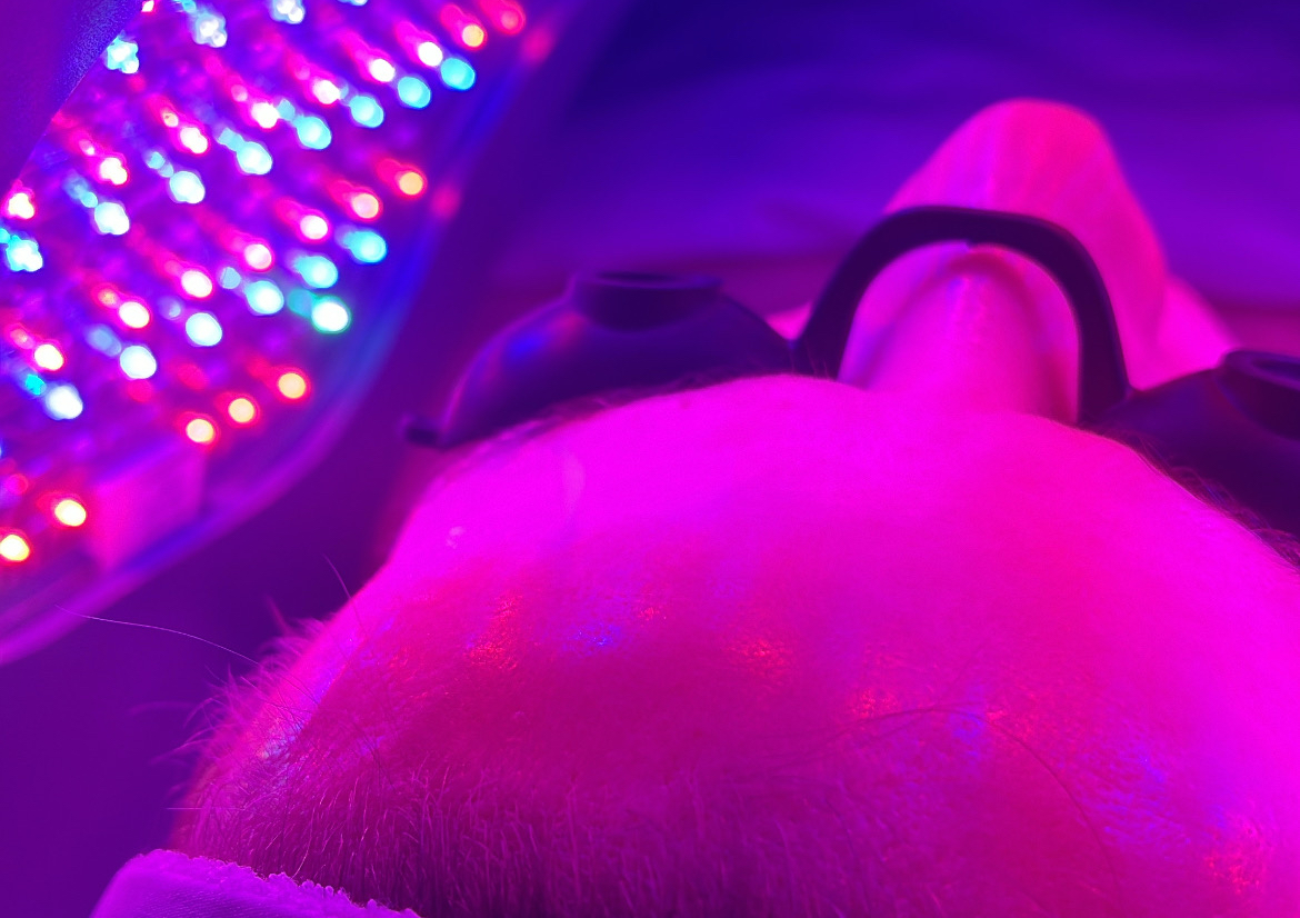 Red Light Therapy Treatment