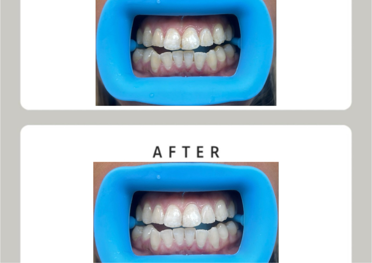 45 min - Signature Whitening