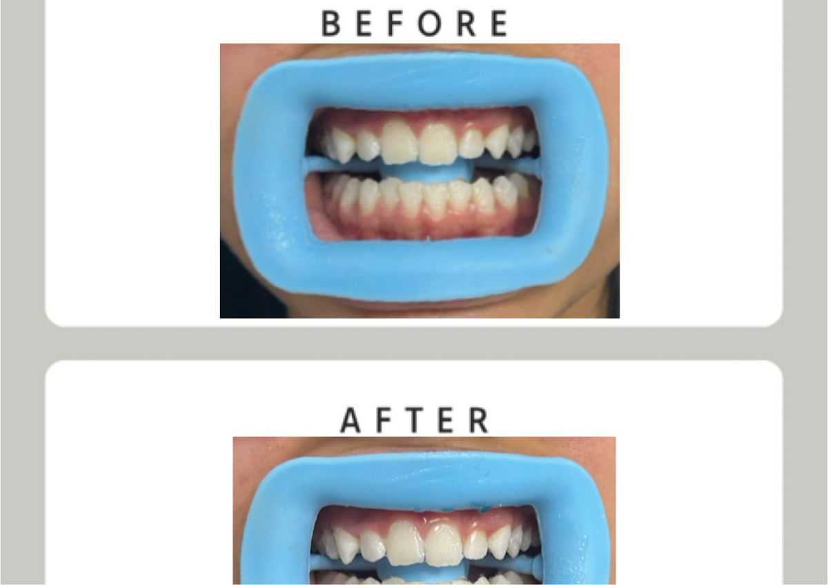 30 min - Express Glow