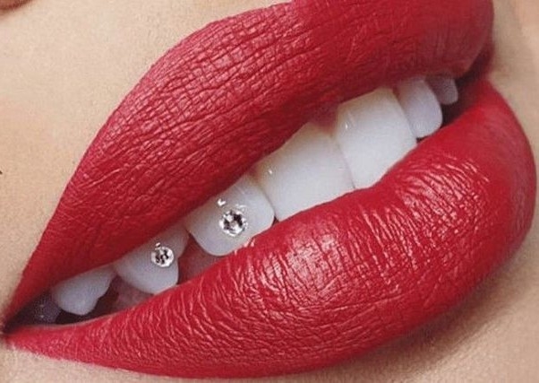 💎 Basic Single Tooth Gem 💎