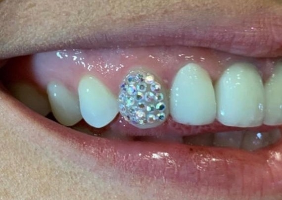 💎 Full Tooth (Cluster) of Gems 💎
